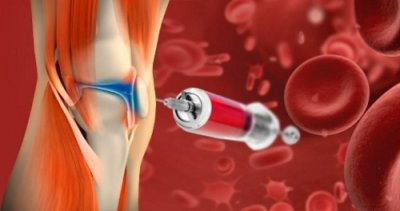 A description of the image.